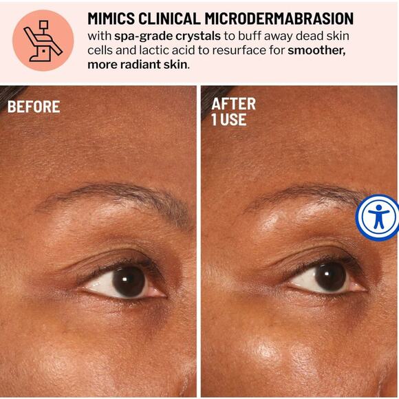 Dr. Brandt microdermabrasion
ADVANCED FACE EXFOLIATOR - Picture 2 of 7